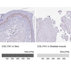 Collagen XVII Antibody, Novus Biologicals:Antibodies:Primary Antibodies